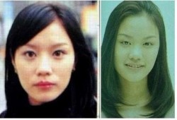 台湾爆料谁整容了啊视频,明星整容真相大曝光！